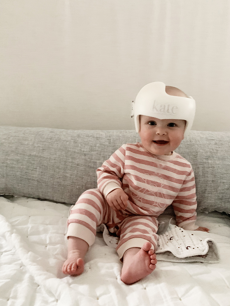 Why Our Baby is Wearing a Helmet